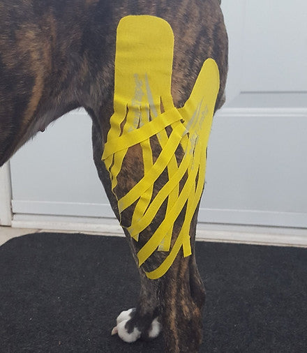 Kinesiology Taping Application